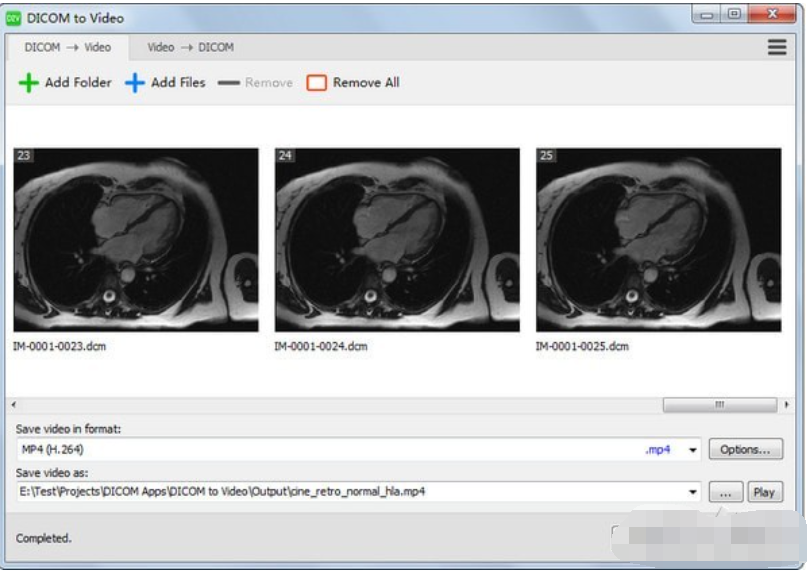 DICOM to Video(DICOM转视频工具)